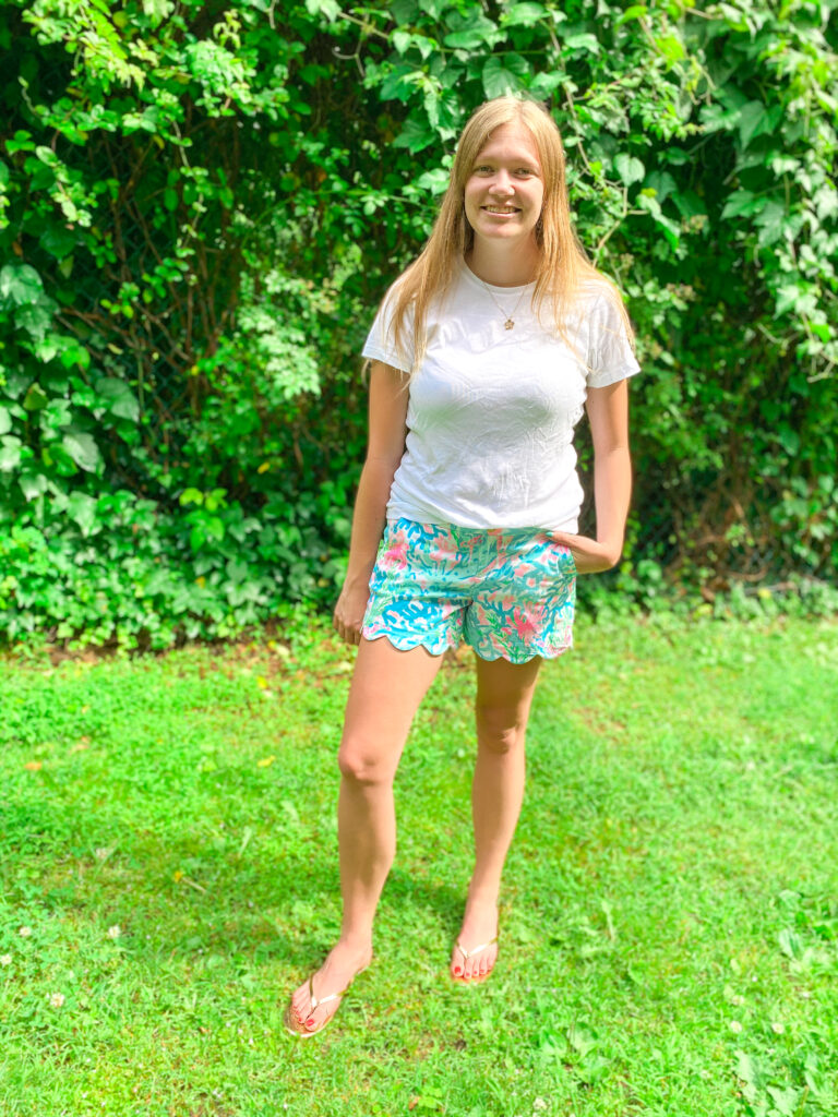 5 Summer Shoes you need this summer: flip flops.